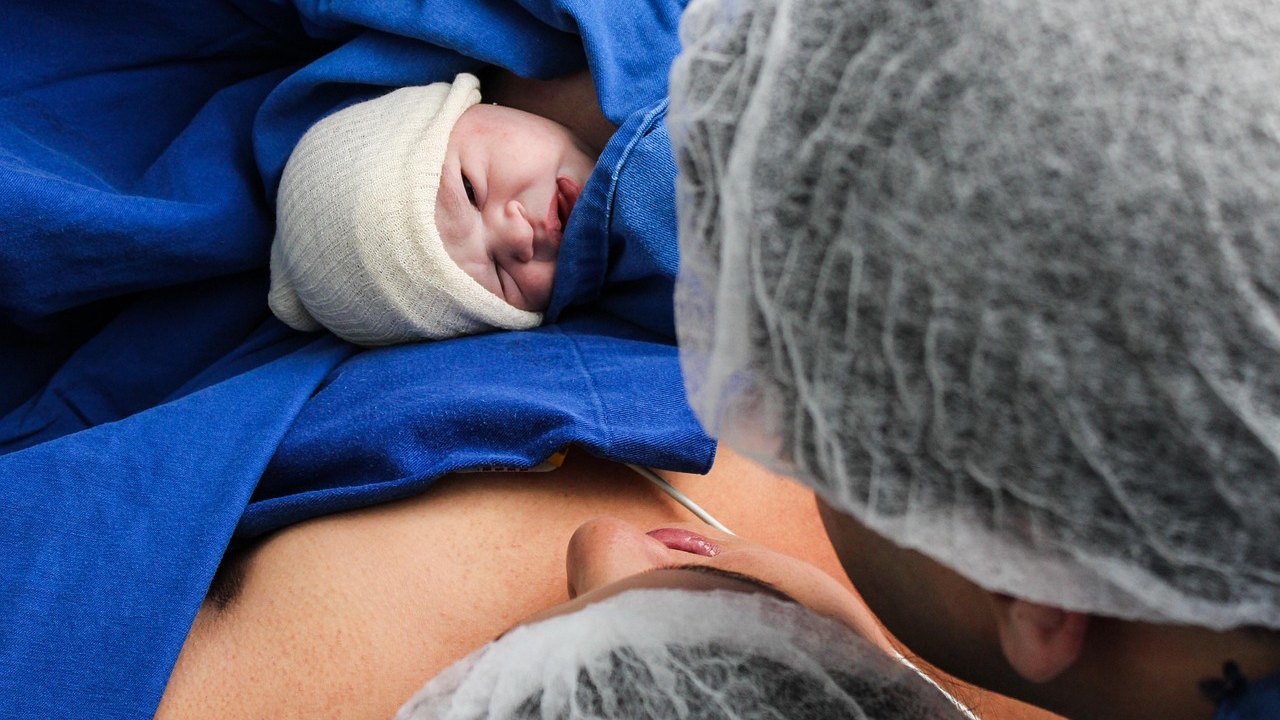 operating room cesarean surgery