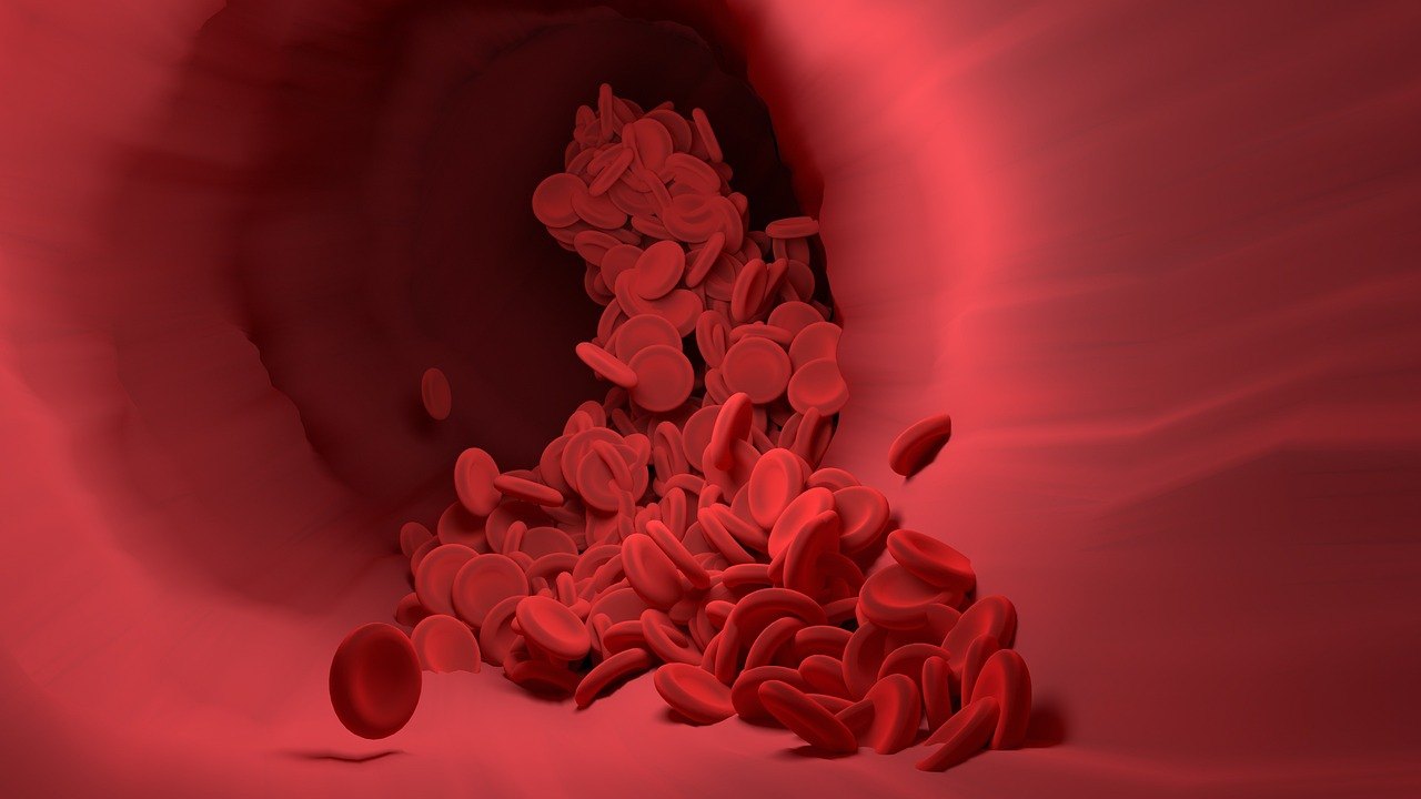 Carotid Stenosis Stenting and Cognition: CREST-H Results