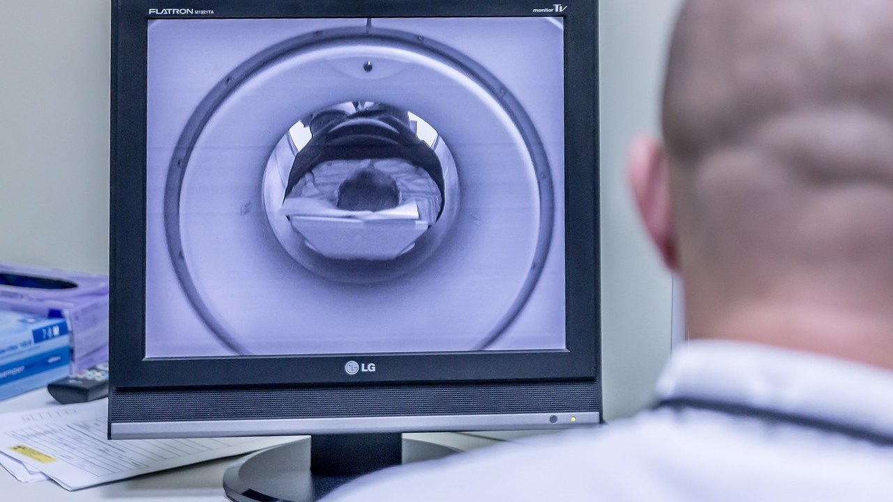 brain MRI scan on screen in hospital