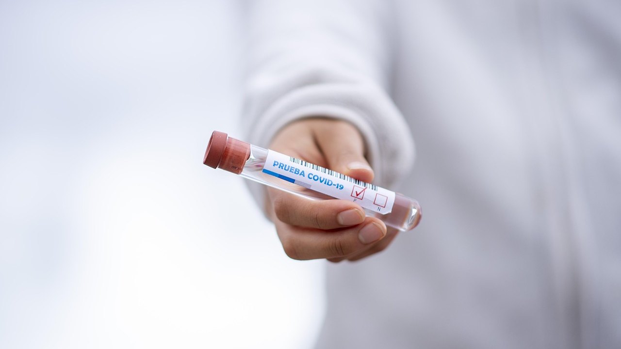 cholesterol blood test laboratory