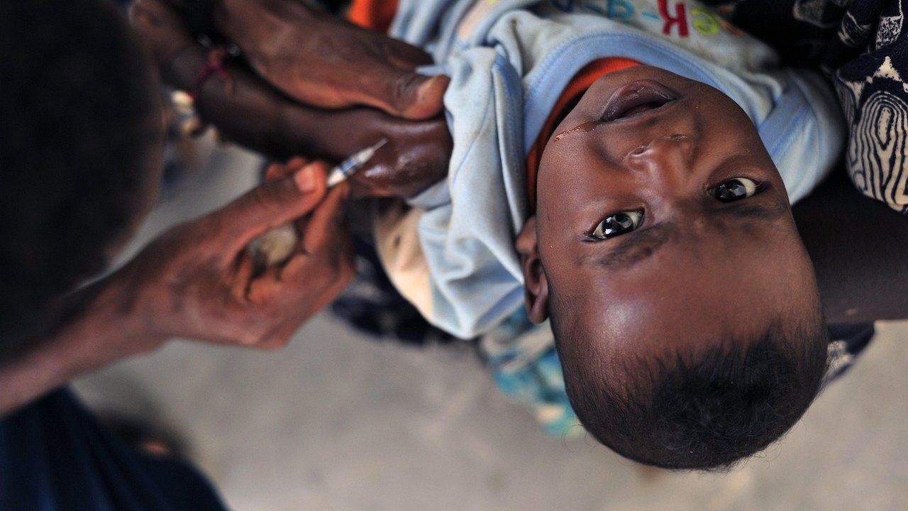 Measles Resurgence: GBD 2023 Data and USMLE High-Yield Facts