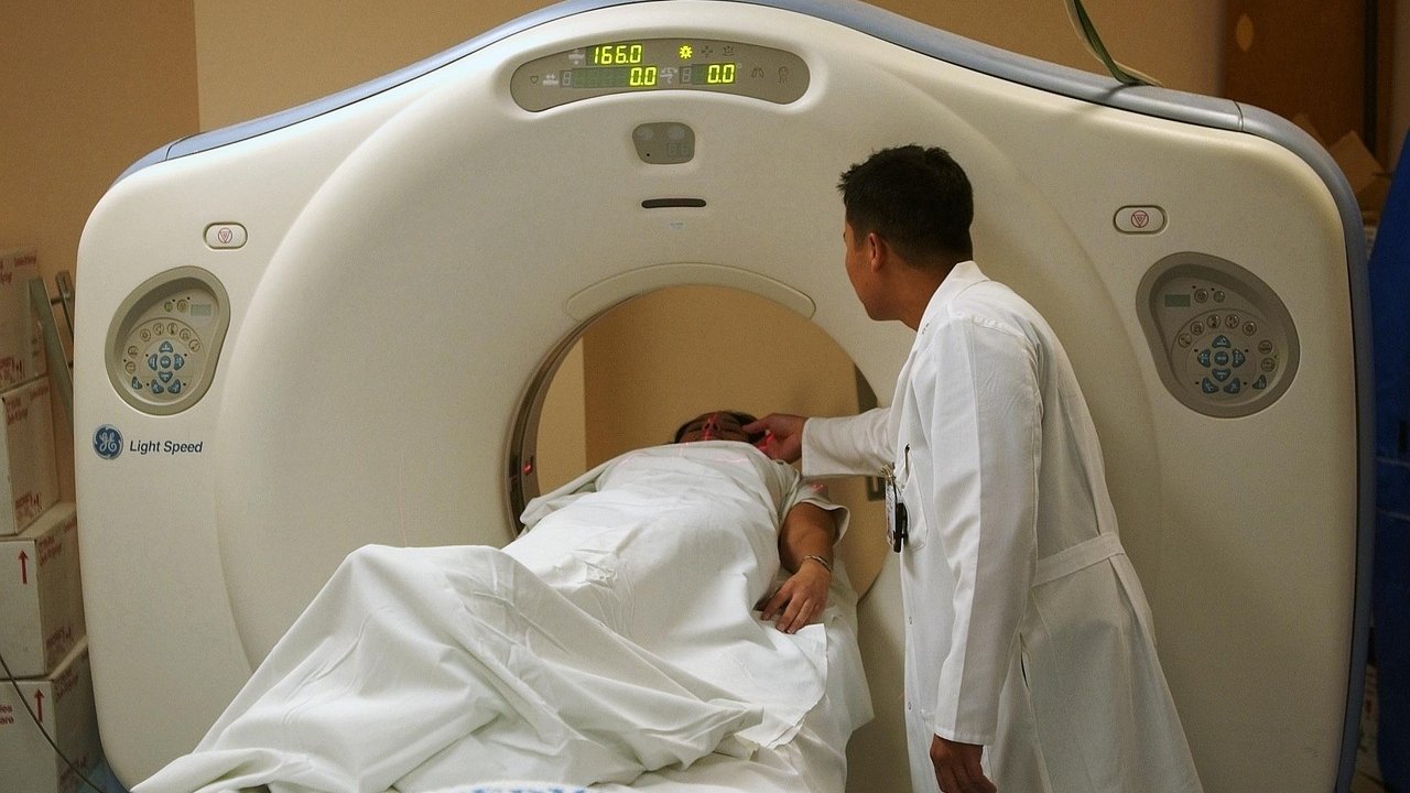 doctor studying lung CT scan