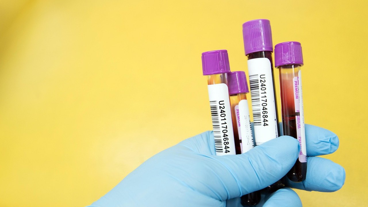 laboratory blood serum samples in tubes