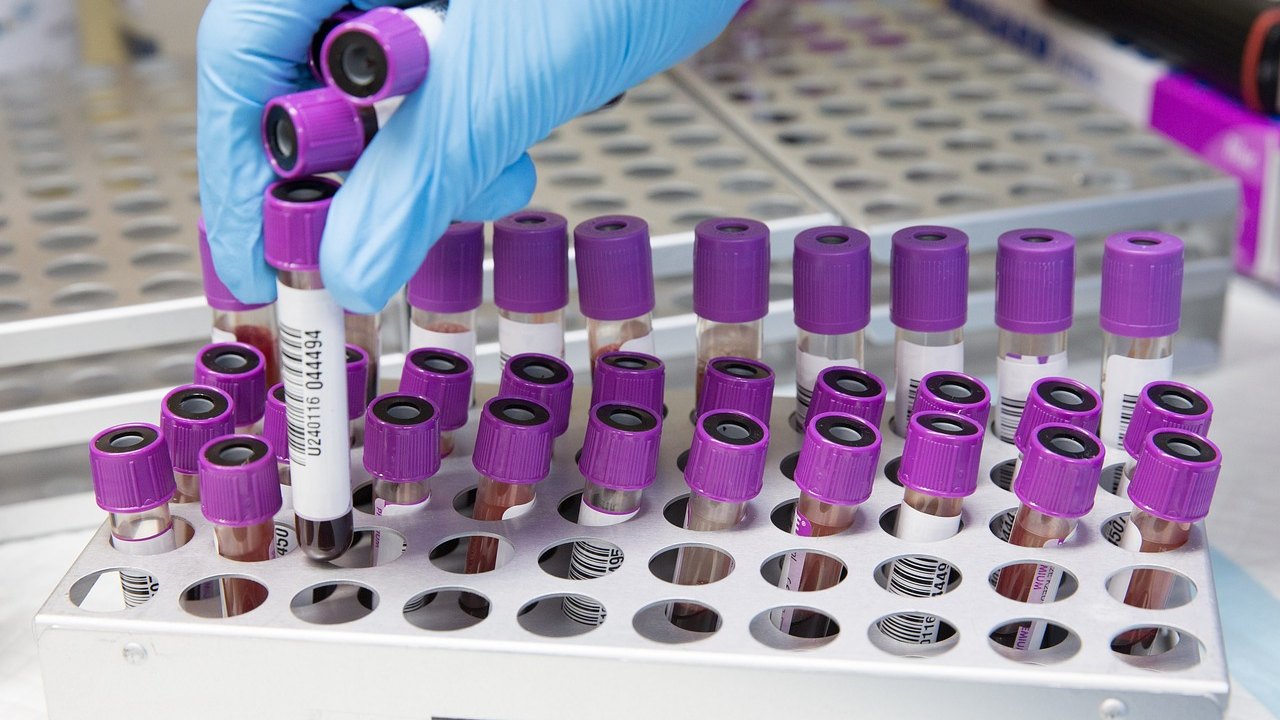 laboratory blood sample tubes in rack