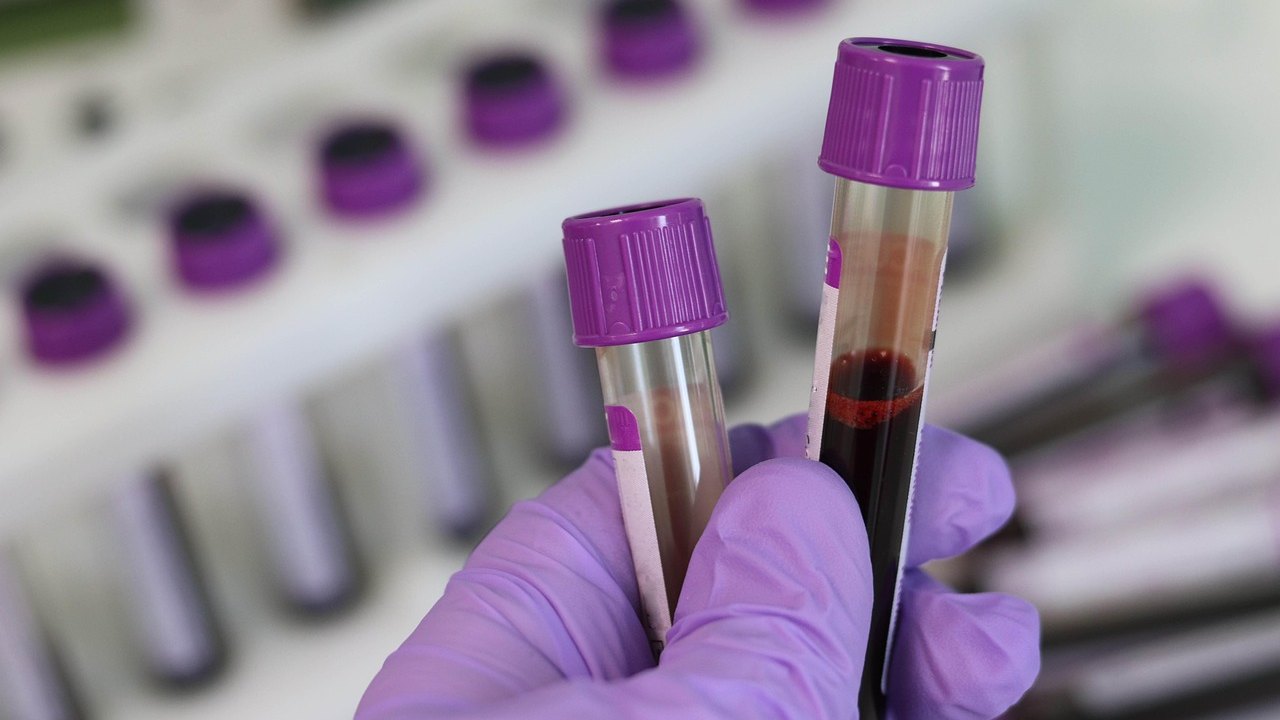 laboratory blood test tubes