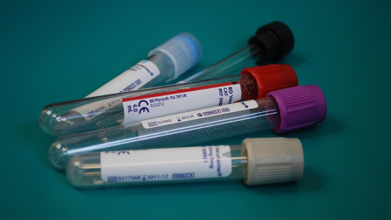 laboratory blood sample tubes