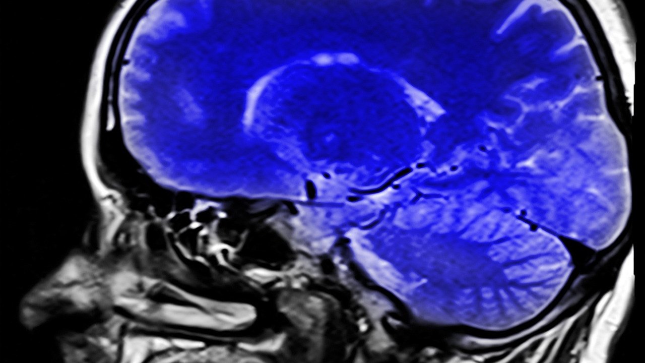 neurology brain MRI scan radiology
