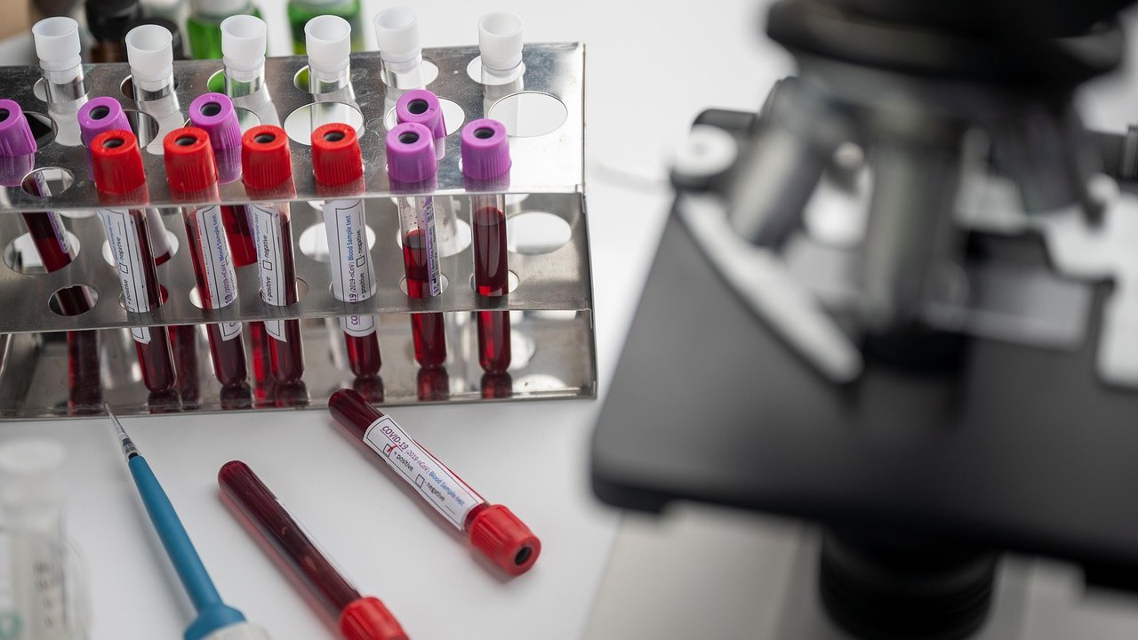 blood test laboratory tubes microscope